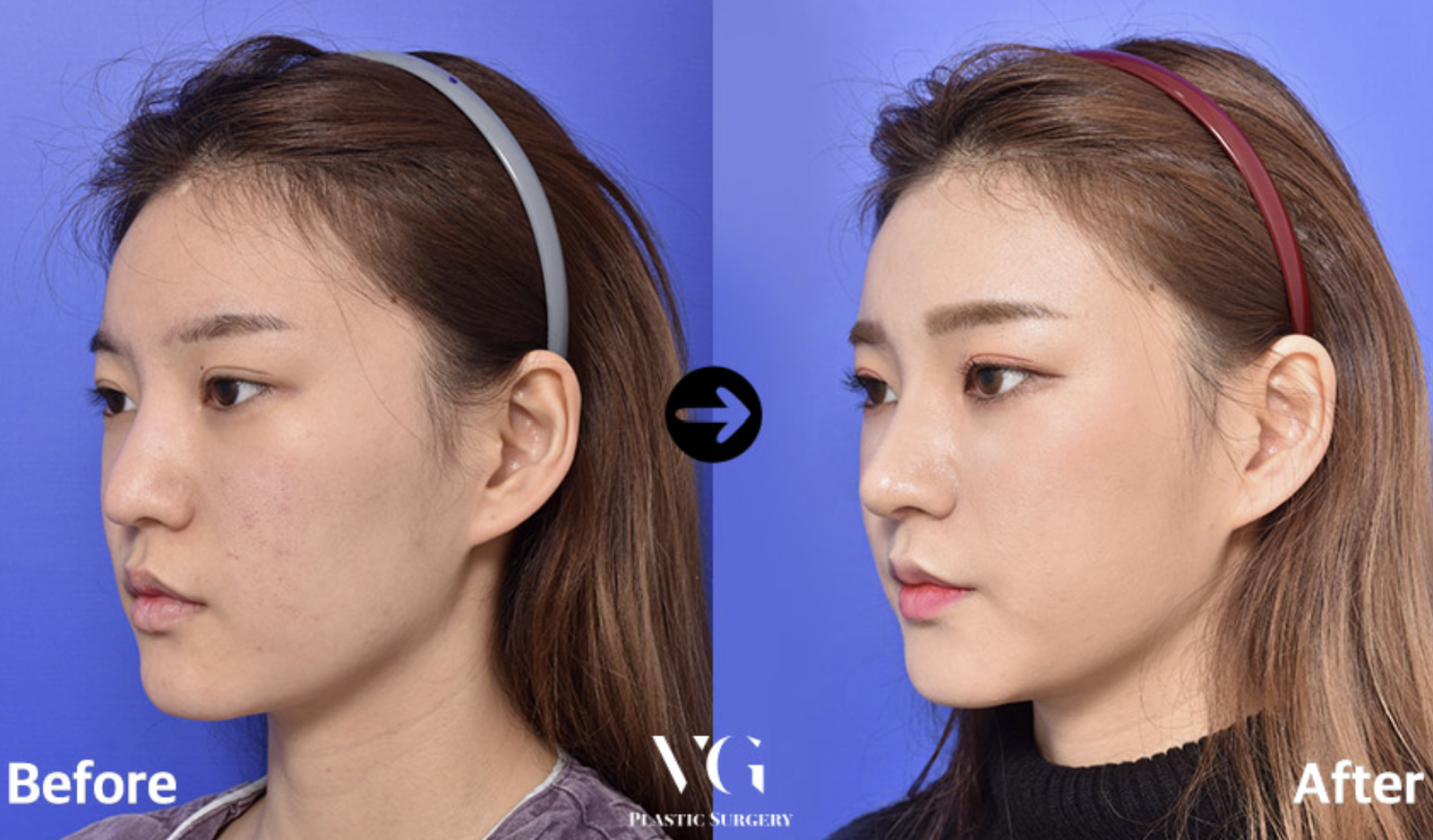 화면 캡처 2025-01-23 203843