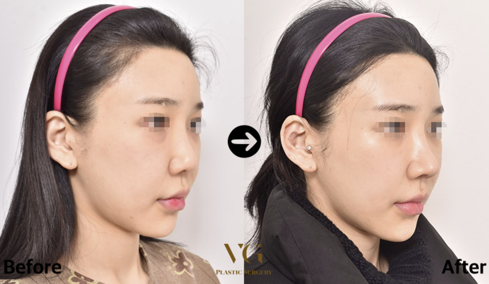 화면 캡처 2025-01-23 203926
